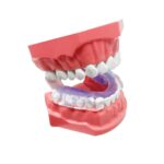 AIRWAAV-Recovery-RX1-Mouthpiece-Teeth